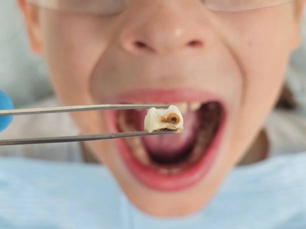 Best Dental Emergency Near Me  in Mcconnell Af, KS